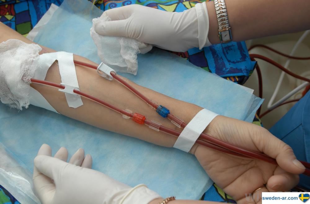 وفاة رجل في السويد بعد عملية نقل دم خاطئة